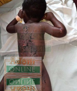 abused on a 3 year old son