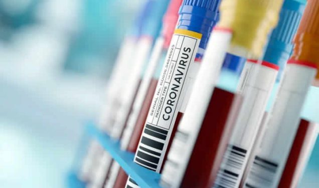 Coronavirus in Ghana