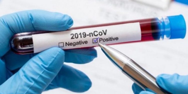 Tech Error Leads To Over 11,000 Unreported Covid-19 Cases In Wales