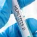 A National Guideline For Hepatitis B Testing Has Been Requested From The Government