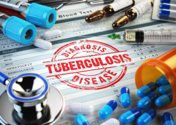 South African Researchers : HIV-positive adolescents more likely to contract TB