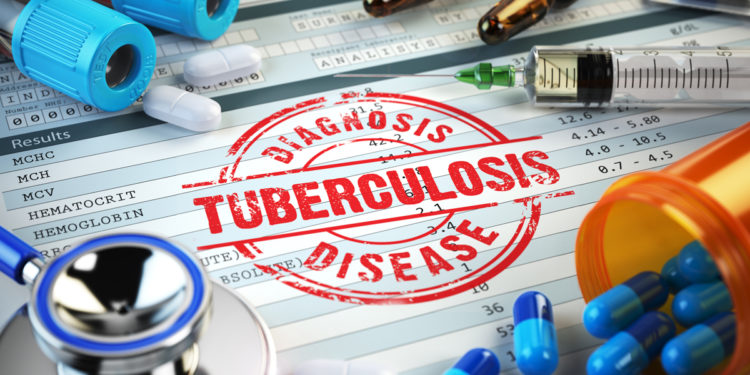 South African Researchers : HIV-positive adolescents more likely to contract TB
