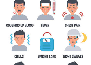 tb-focal-person-urges-public-to-seek-early-medical-assistance