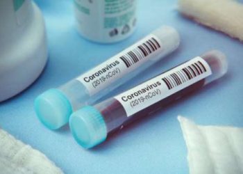 Disregard the notion that COVID-19 is no longer a threat to the country - GHS, GCNM warns