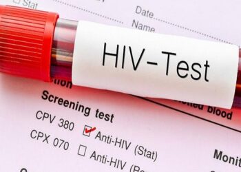 23,495 Ghanaians test positive for HIV in 6 months