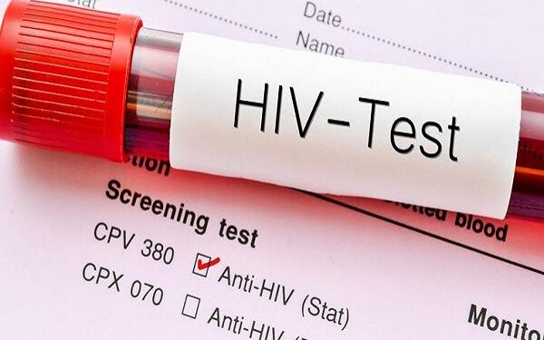 23,495 Ghanaians test positive for HIV in 6 months