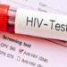 23,495 Ghanaians test positive for HIV in 6 months