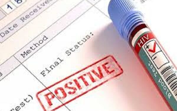 7,699 children tested positive for HIV in 2020 – NACP