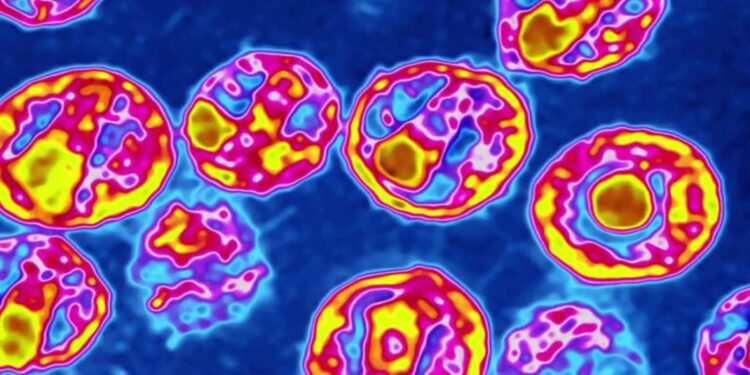 5th person confirmed to be cured of HIV