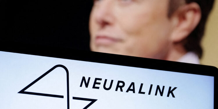 Musk’s brain implant company in search of human trials partner