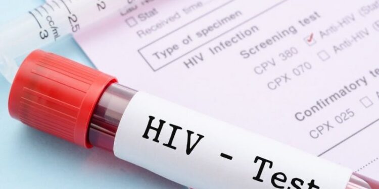 HIV self-test Kit