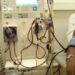 Kidney dialysis: Renal Unit at Korle-Bu to be re-opened today