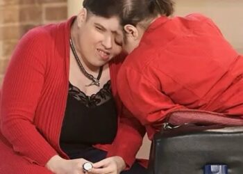 Oldest living conjoined twins and oldest female conjoined twins dead