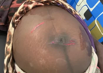 Oti Region: Husband inflicts cutlass wounds on pregnant wife