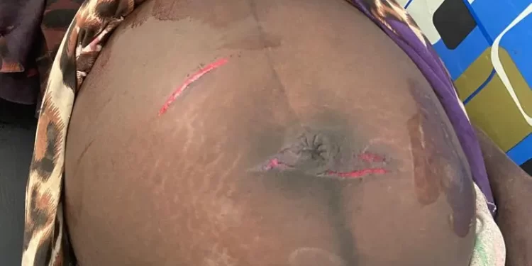 Oti Region: Husband inflicts cutlass wounds on pregnant wife