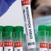 Mpox Outbreak in DR Congo Raises Concerns of International Spread