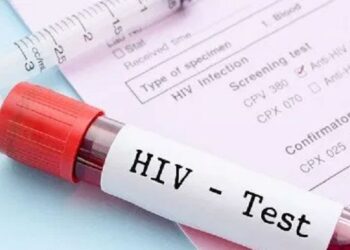V/R: Two people contract HIV daily - NACP
