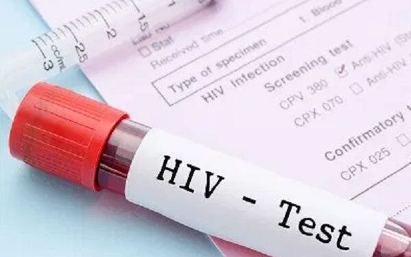 V/R: Two people contract HIV daily - NACP