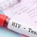 V/R: Two people contract HIV daily - NACP