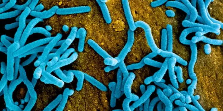 Rwanda limits funeral sizes due to Marburg virus outbreak