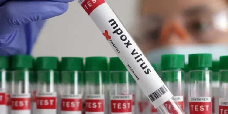 WHO approves first mpox test for quick diagnosis