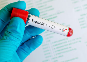 A medical herbalist at the Medi-Moses Centre, Dr. Prince Osei, has advised individuals to undergo proper testing before taking medication for typhoid fever.