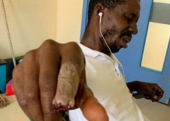 Twifo Atimorkwa NPP Constituency Youth Organiser Granted Bail in Finger-Biting Case