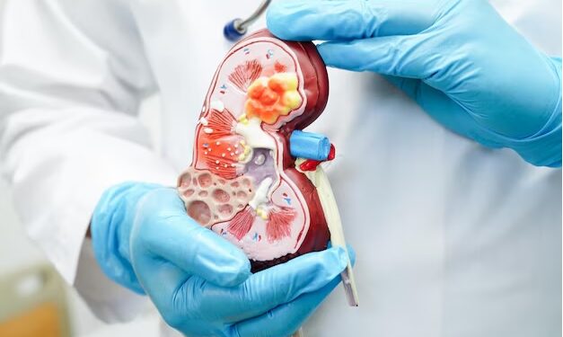 As Ghana joins the world in marking World Kidney Day, Dr. Susan Adu-Amankwah, Clinical Research Coordinator at the Noguchi Memorial Institute, has emphasized the need to shift the focus from treatment alone to prevention and health promotion.