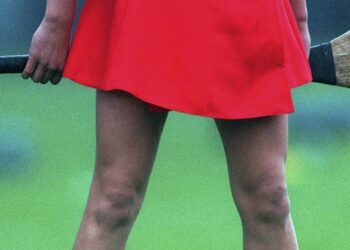 Skorts vs Shorts Vote: What You Need to Know