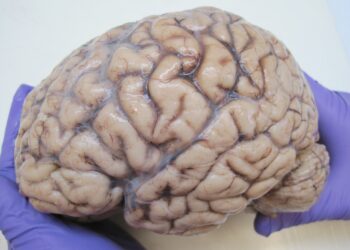 Only 16 Neurologists and 2 Public MRI Machines Serving Millions in Ghana – Expert Reveals