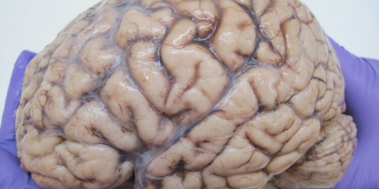 Only 16 Neurologists and 2 Public MRI Machines Serving Millions in Ghana – Expert Reveals